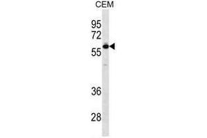 TBX5 Antibody (N-term) western blot analysis in CEM cell line lysates (35ug/lane). (T-Box 5 Antikörper  (N-Term))
