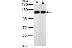 WB Image Sample (30 ug of whole cell lysate) A: H1299 B: Hela 7. (KAP1 Antikörper)