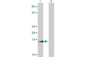 Western Blotting (WB) image for anti-ATPase, H+ Transporting, Lysosomal 13kDa, V1 Subunit G2 (ATP6V1G2) (AA 41-118) antibody (ABIN513637)