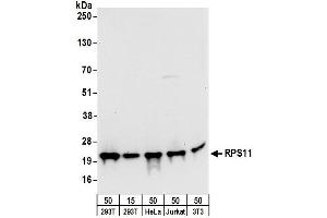 anti-Ribosomal Protein S11 (RPS11) (AA 1-50) antibody