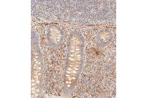 Immunohistochemical analysis of paraffin-embedded human epityphlon tissue using (ABIN392563 and ABIN2842106) performed on the Leica® BOND RXm. (PIK3CD Antikörper  (C-Term))