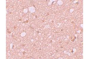 Immunohistochemical staining of human brain cells with SESTD1 polyclonal antibody  at 5 ug/mL. (SESTD1 Antikörper  (C-Term))