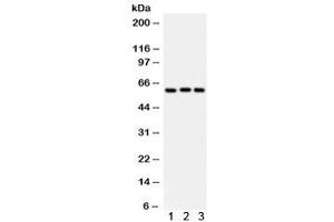 Western blot testing of 1) rat liver, 2) human placenta, 3) A549 lysate with Heparanase 1 antibody. (HPSE Antikörper)