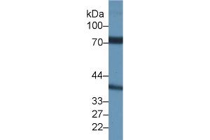 Western Blot; Sample: Rat Testis lysate; Primary Ab: 1µg/ml Rabbit Anti-Rat NCSTN Antibody Second Ab: 0. (Nicastrin Antikörper  (AA 35-534))