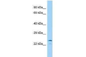 Host: Rabbit Target Name: IYD Sample Type: 293T Whole Cell lysates Antibody Dilution: 1. (IYD Antikörper  (N-Term))