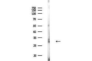 anti-Charged Multivesicular Body Protein 1B (CHMP1B) (C-Term) antibody