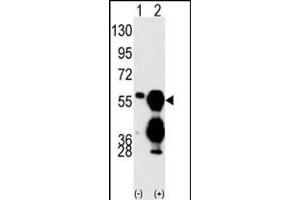 Western blot analysis of M1F (arrow) using M1F Antibody (C-term) (ABIN392884 and ABIN2842288). (PPM1F Antikörper  (C-Term))