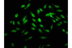 Immunofluorescence staining of Hela cells with ABIN7155739 at 1:166, counter-stained with DAPI. (HOXB4 Antikörper  (AA 88-166))
