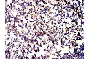 Immunohistochemistry (IHC) image for anti-Integrin alpha-L (ITGAL) (AA 26-194) antibody (ABIN7193238)