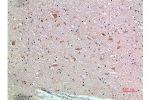 Immunohistochemical analysis of paraffin-embedded human-brain, antibody was diluted at 1:200 (FZD9 Antikörper  (AA 1-50))