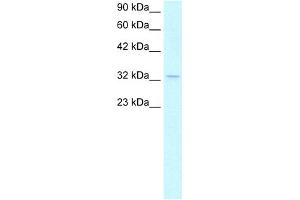WB Suggested Anti-NPM1 Antibody Titration:  1. (NPM1 Antikörper  (C-Term))