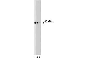 Western blot analysis of Hsp60 on a Jurkat lysate (ABIN968537).