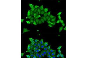 Immunofluorescence analysis of A-549 cells using CA1 Polyclonal Antibody (CA1 Antikörper)