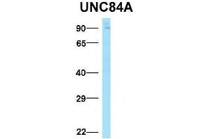 Western Blotting (WB) image for anti-Sad1 and UNC84 Domain Containing 1 (SUN1) (N-Term) antibody (ABIN2783971)