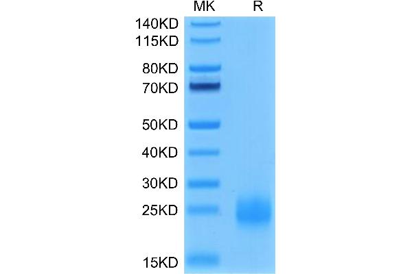 TIGIT Protein (AA 22-141) (His tag)