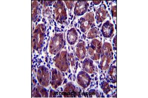 Immunohistochemistry (Paraffin-embedded Sections) (IHC (p)) image for anti-Eukaryotic Translation Initiation Factor 2 Subunit 1 (EIF2S1) (AA 60-89), (N-Term) antibody (ABIN657392)
