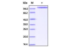 Biotinylated Human Her2, Superior Sensitivity on SDS-PAGE under reducing (R) condition. (ErbB2/Her2 Protein (AA 23-652) (His tag,Biotin))