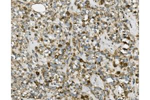 IHC analysis of TRIM25 using anti-TRIM25 antibody (ABIN7599495).