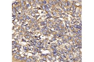 IHC analysis of IFIT5 using anti-IFIT5 antibody (ABIN7600752). (IFIT5 Antikörper  (AA 23-439))