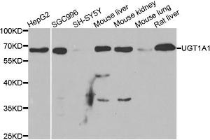 Western blot analysis of extracts of various cell lines, using μgT1A1 antibody (ABIN5973637) at 1/1000 dilution. (UGT1A1 Antikörper)