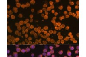Immunofluorescence analysis of THP-1 cells using TNFRSF10A Polyclonal Antibody at dilution of 1:100 (40x lens). (TNFRSF10A Antikörper)