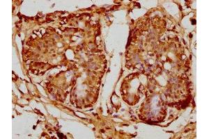 Immunohistochemistry (IHC) image for anti-Proteasome (Prosome, Macropain) Subunit, beta Type, 8 (Large Multifunctional Peptidase 7) (PSMB8) (AA 176-276) antibody (ABIN7164990)