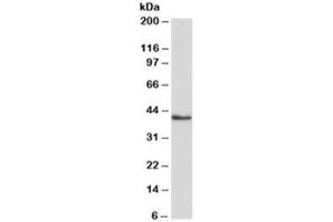 Western blot testing of K562 lysate with HMBS antibody at 0. (HMBS Antikörper)
