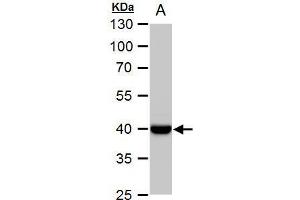 Western Blotting (WB) image for anti-Wingless-Type MMTV Integration Site Family, Member 11 (WNT11) (Center) antibody (ABIN2856232)