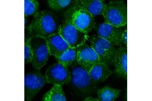 IF analysis of P cadherin/CDH3 using anti-P cadherin/CDH3 antibody (ABIN6719500). (P-Cadherin Antikörper  (AA 126-336))