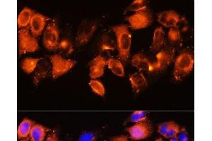 Immunofluorescence analysis of HeLa cells using IGFBP5 Polyclonal Antibody at dilution of 1:100.
