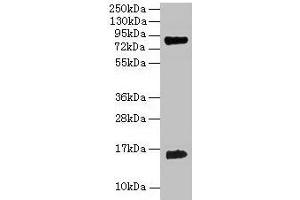 Western blot All lanes: Hemoglobin polyclonal antibody at 2 μg/mL + 293T whole cell lysate Secondary Goat polyclonal to rabbit IgG at 1/15000 dilution Predicted band size: 16 kDa Observed band size: 16 kDa (Hemoglobin Antikörper)