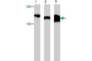 Western blot analysis of extract from Myc-CIBZ protein (lane 1) , mouse brain tissue (lane 2) and mouse kidney tissue (lane 3) , using Zbtb38 polyclonal antibody  . (ZBTB38 Antikörper)