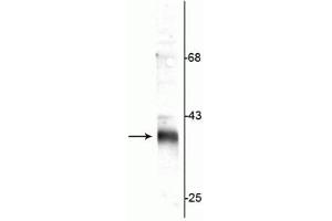 Western blot of rat synaptic plasma membrane (SPM) lysate showing specific immunolabeling of the ~36 kDa stargazin protein. (Stargazin Antikörper  (C-Term))