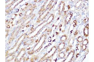 Immunohistochemistry of paraffin-embedded mouse kidney using ACADM Rabbit mAb (ABIN1678538, ABIN3019056, ABIN3019057 and ABIN7101707) at dilution of 1:100 (40x lens). (Medium-Chain Specific Acyl-CoA Dehydrogenase, Mitochondrial Antikörper)