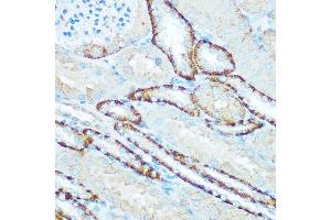 Immunohistochemistry of paraffin-embedded mouse kidney using H Rabbit pAb (ABIN6131125, ABIN6137333, ABIN6137334 and ABIN6220624) at dilution of 1:100 (40x lens).