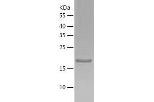 Western Blotting (WB) image for MRG-Binding Protein (MRGBP) (AA 1-204) protein (His tag) (ABIN7124025) (MRGBP Protein (AA 1-204) (His tag))