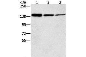 Western Blot analysis of Jurkat, A172 and A549 cell using SMC2 Polyclonal Antibody at dilution of 1:300