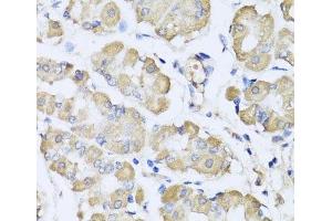 Immunohistochemistry of paraffin-embedded Human stomach using L2HGDH Polyclonal Antibody at dilution of 1:100 (40x lens). (L2HGDH Antikörper)