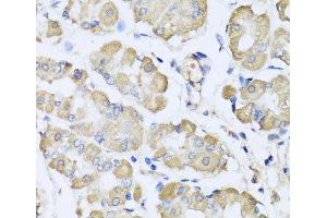 Immunohistochemistry of paraffin-embedded Human stomach using L2HGDH Polyclonal Antibody at dilution of 1:100 (40x lens). (L2HGDH Antikörper)