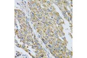Immunohistochemistry (Paraffin-embedded Sections) (IHC (p)) image for anti-Cytochrome P450, Family 1, Subfamily A, Polypeptide 1 (CYP1A1) (AA 200-460) antibody (ABIN3023076)