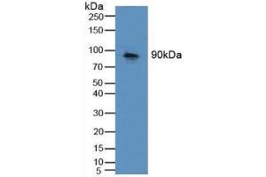 Detection of CDH16 in Mouse Kidney Tissue using Polyclonal Antibody to Cadherin 16 (CDH16) (Cadherin-16 Antikörper  (AA 37-287))