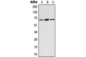 Western blot analysis of Estrogen Receptor alpha (pY537) expression in HeLa (A), SP2/0 (B), rat spleen (C) whole cell lysates. (Estrogen Receptor alpha Antikörper  (C-Term, pTyr537))