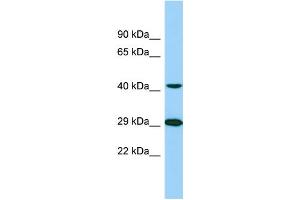 Western Blotting (WB) image for anti-Tubulin tyrosine Ligase-Like Family, Member 1 (TTLL1) (C-Term) antibody (ABIN2789136)