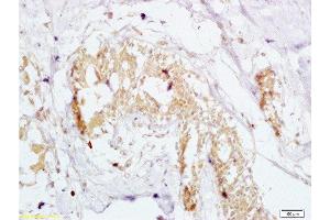 Immunohistochemistry (Paraffin-embedded Sections) (IHC (p)) image for anti-GTP-Binding Protein 10 (GTPBP10) (AA 151-250) antibody (ABIN750748)