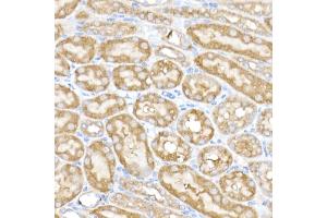 Immunohistochemistry of paraffin-embedded mouse kidney using MK4 Rabbit mAb (ABIN7268653) at dilution of 1:50 (40x lens). (MAP3K4 Antikörper)