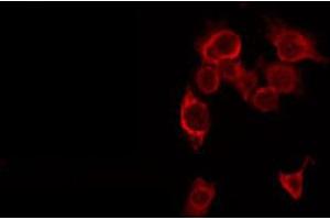 ABIN6266593 staining HepG2 by IF/ICC. (MMP16 Antikörper  (C-Term))