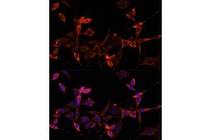 Immunofluorescence analysis of NIH-3T3 cells using S1/PR Polyclonal Antibody (ABIN6129890, ABIN6136741, ABIN6136742 and ABIN6221835) at dilution of 1:100 (40x lens). (PRAS40 Antikörper  (AA 152-276))