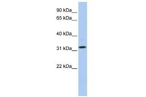 WB Suggested Anti-C15orf26 Antibody Titration: 0. (C15orf26/CFAP161 Antikörper  (C-Term))