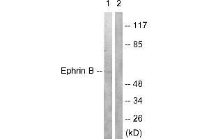Western blot analysis of extracts from 293 cells treated with EGF (200ng/ml, 5mins), using Ephrin B (Ab-330) antibody (#B0010, Line 1 and 2). (EFNB1/2 (Tyr330) Antikörper)