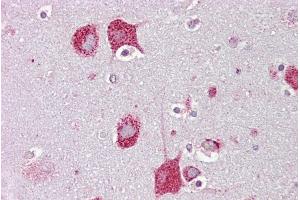 Immunohistochemistry (IHC) image for anti-Hexosaminidase A (HEXA) (C-Term) antibody (ABIN2788673)